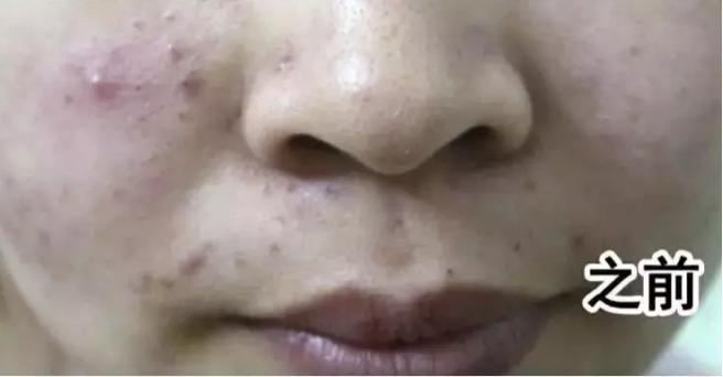 头油头屑痒洗发水,头油头皮屑多脱发洗发水