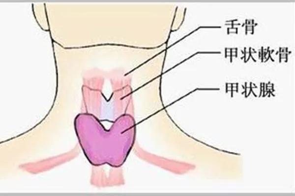 亚急性甲状腺炎好转睡眠能恢复吗,甲状腺激素过高影响睡眠怎么办