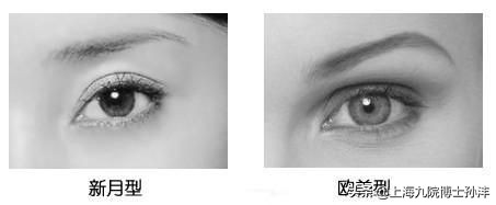 明明是双眼皮却老是不显为什么,为什么割了双眼皮反而不好看了