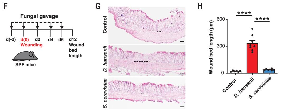 奶酪可以改善肠道吗,奶酪里有酵母菌