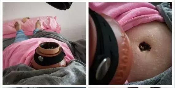 怎么判断宝宝湿气重,怎样才知道宝宝体内有湿气