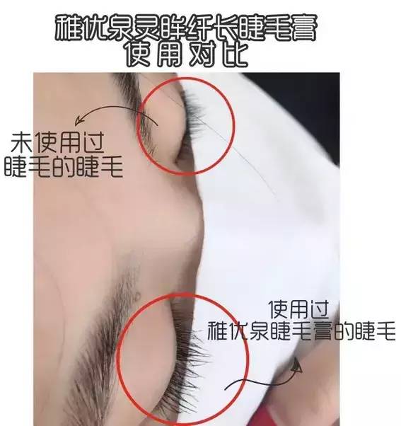 睫毛翘睫术怎么弄直,睫毛短小妙招