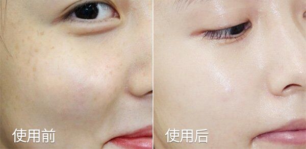 琚佸濮楁帹鑽愯憽钀勭苯鎶よ偆,琚佸濮楄憽钀勭苯绮惧崕