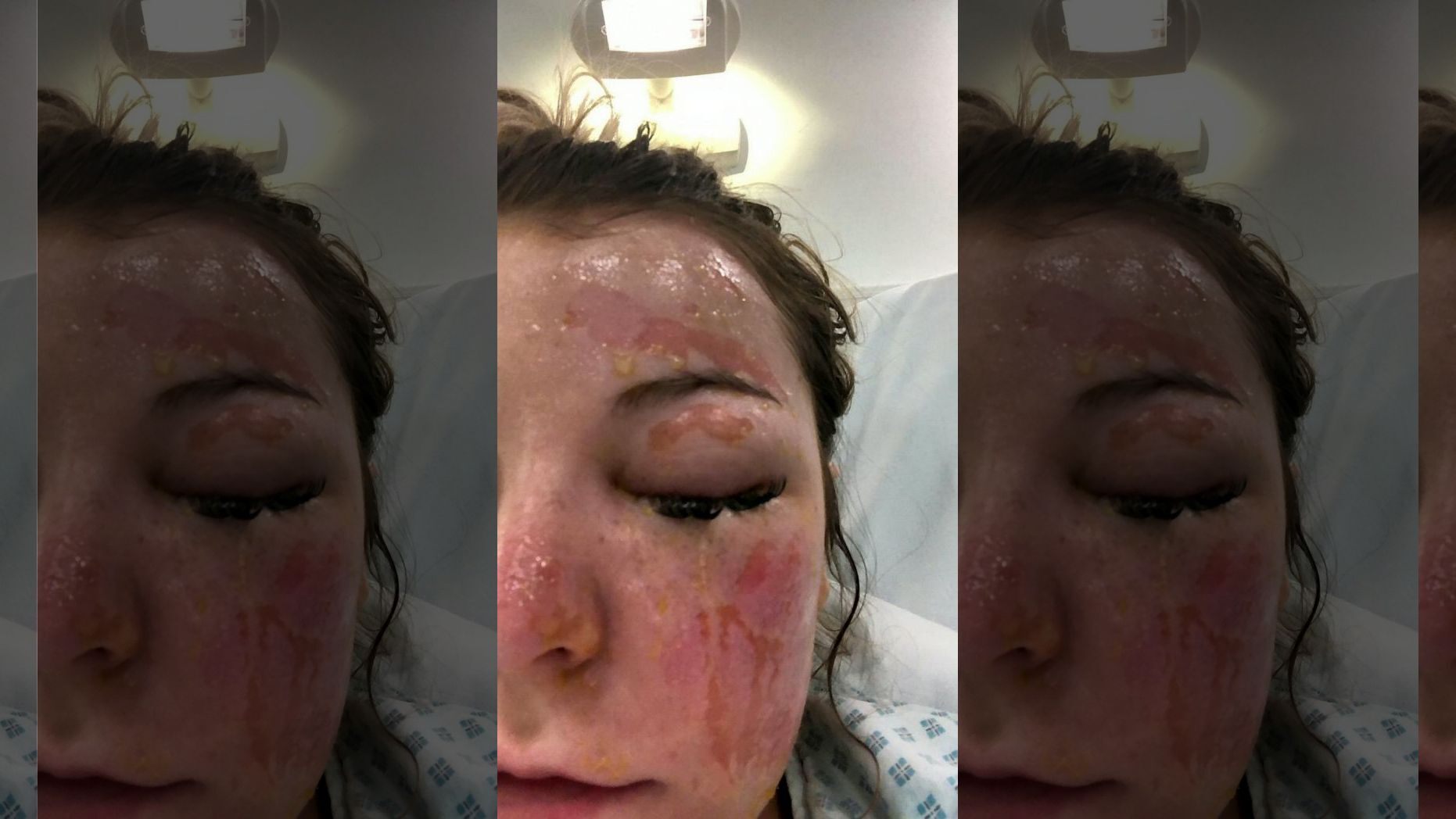 微波炉煮鸡蛋爆炸的视频,微波炉煮荷包蛋爆炸视频