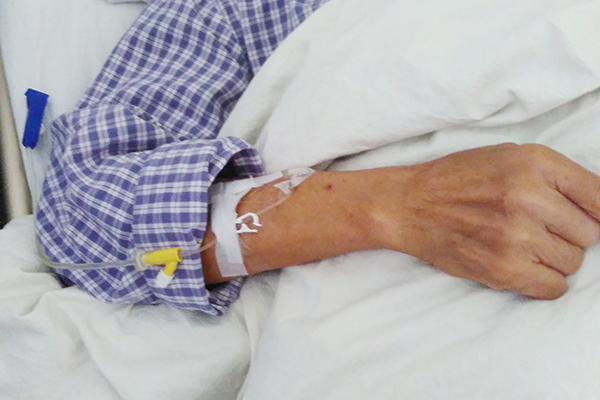 老年斑什么造成的,老年斑的原因是什么引起的