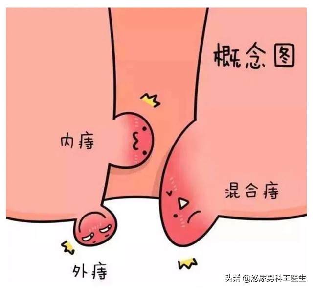 难以启齿的病是什么病,难以启齿的病状