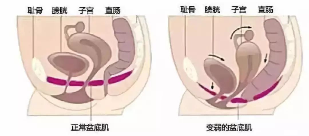 产后夫妻关系不和谐怎么办,产后夫妻关系不好怎么回事