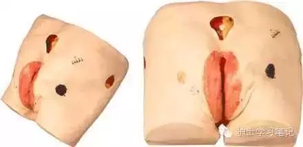 思密达的作用与效果是什么,思密达可以长期用吗