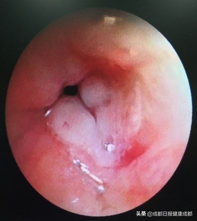 神操作小朋友,神操作视频小孩