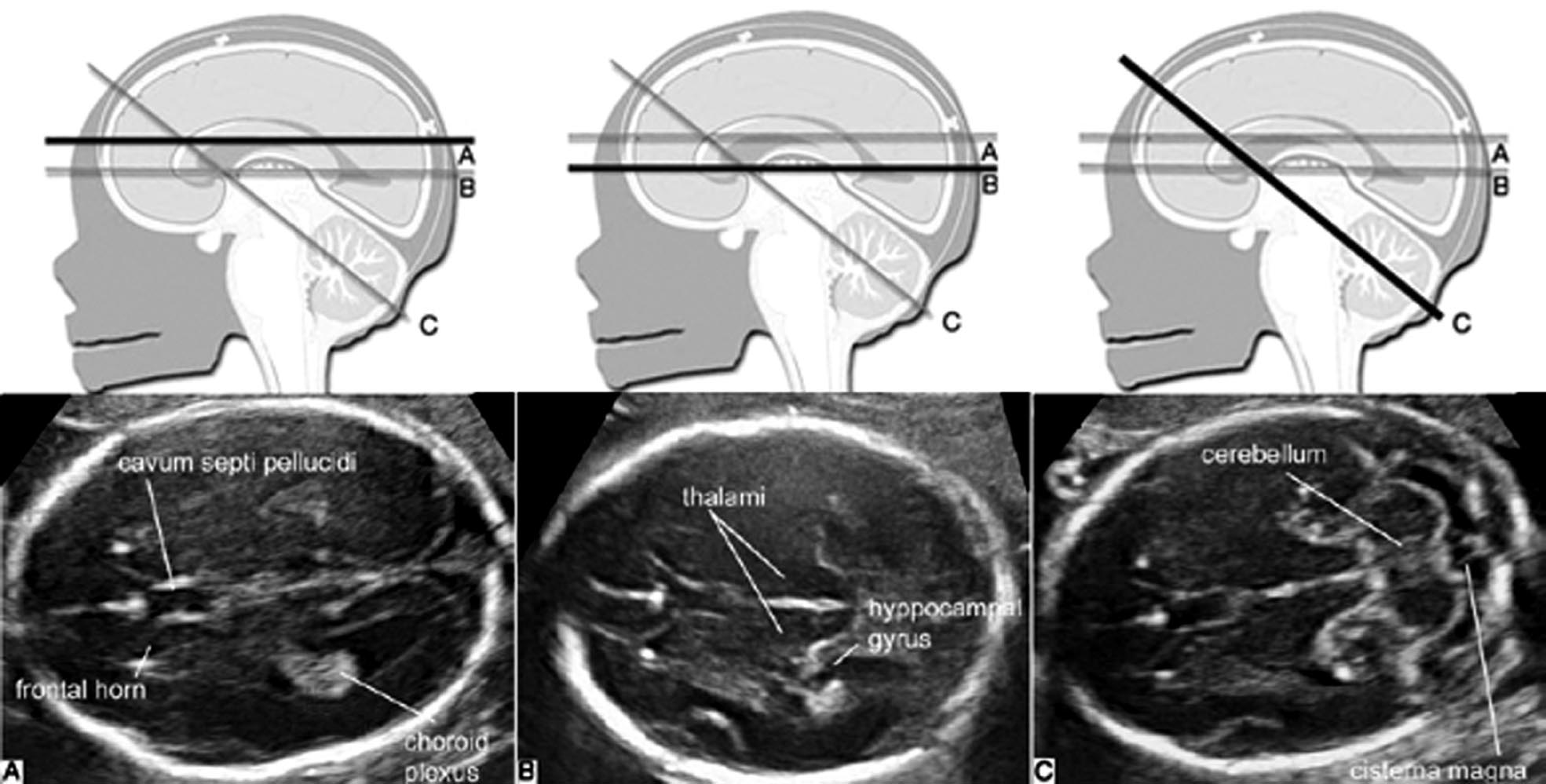 做彩超是不是能清楚看见胎儿,做彩超胎儿仰面平躺