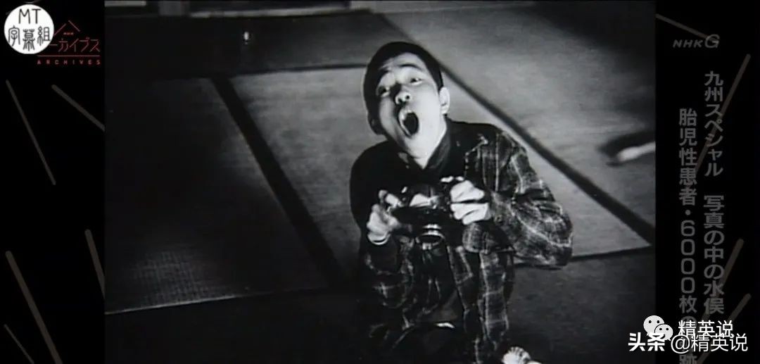 60多年前日本万人中毒成世界公害！如今福岛百万吨核废水入海…