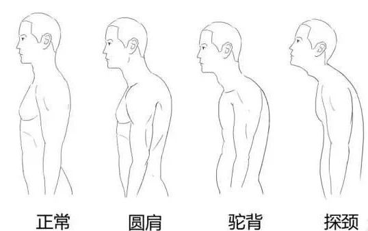 一个动作让你脖子变细,脖子又短又粗怎么办