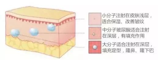 关于水光针，你被忽悠了吗？