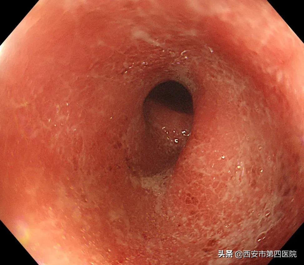 健康中国2023重大行动,健康中国行动是真是假