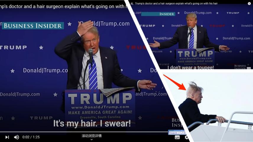 脱发人群超25亿解救头发从它开始,脱发最新研究成果