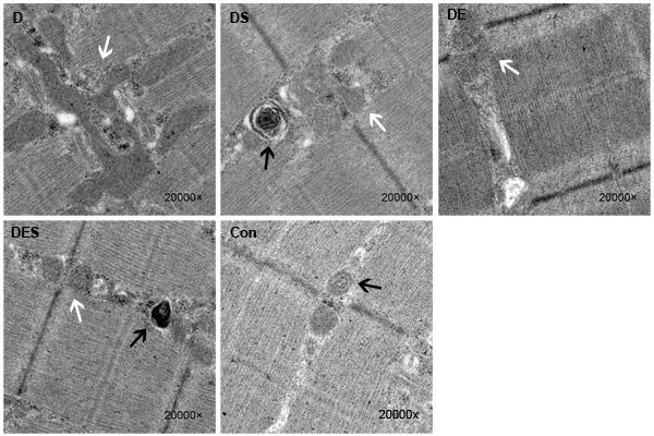 老年人就怕摔倒,老年人怕摔