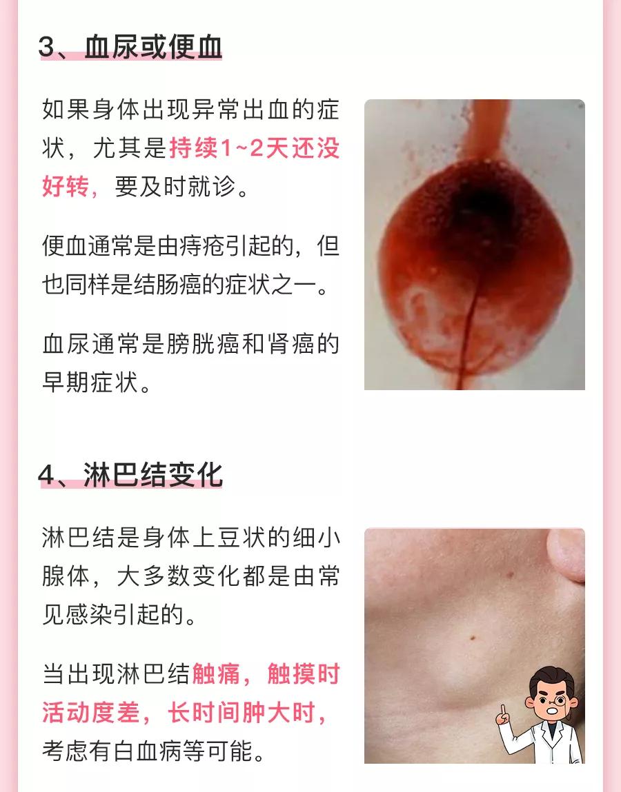 长瘊子会导致宫颈hpv感染吗,脚上长瘊子是身体有hpv病毒吗