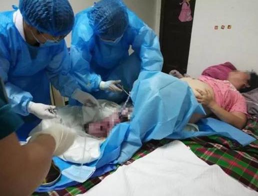 生完双胞胎肚子还在动,刚生完双胞胎老婆说肚子还在动