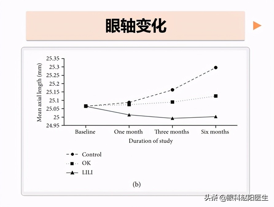 近视眼轴缩短什么原因,缩短眼间距的方法
