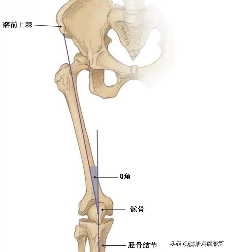 髌股关节疼痛综合症的检测方法,髌股关节疼痛综合征