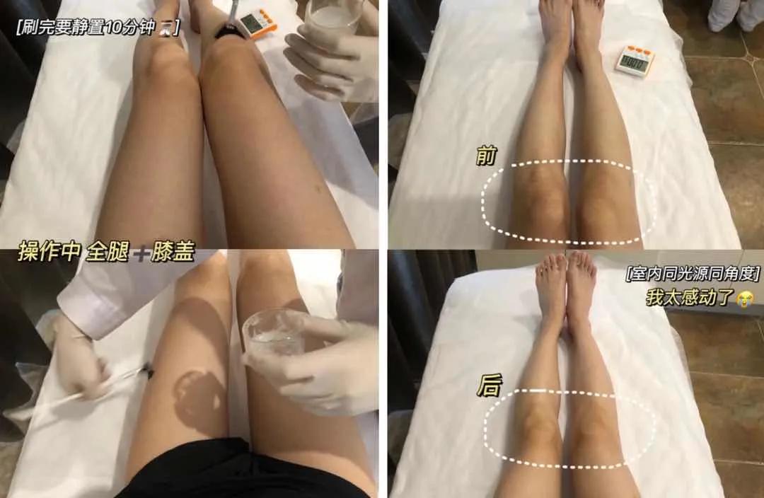 夏天露肉的季节,露肉的正确美白方法