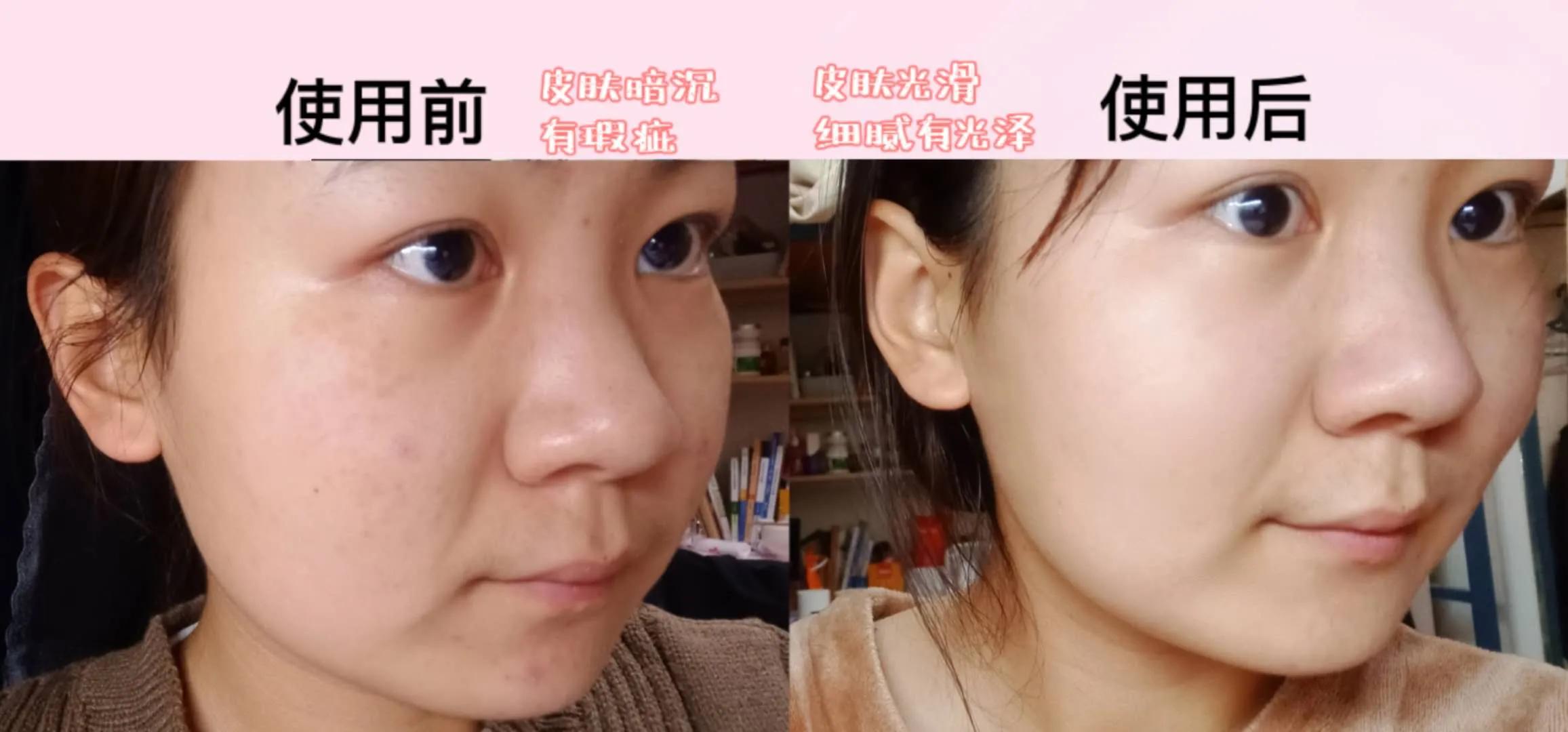 夏季干皮补水哪个牌子好,40岁混干皮夏季适合什么护肤品