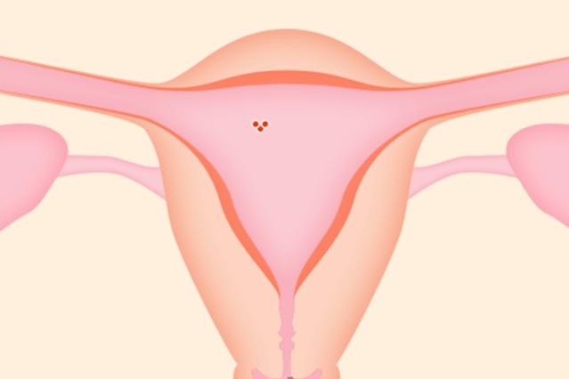 把握好移植时间提高试管妊娠率,试管婴儿移植后的黄金48小时