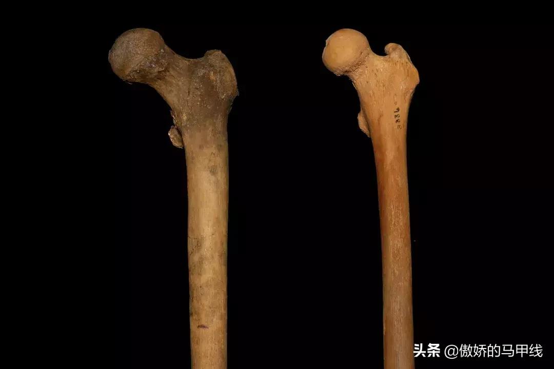 深蹲屁股眨眼如何改善,深蹲屁股眨眼正确吗