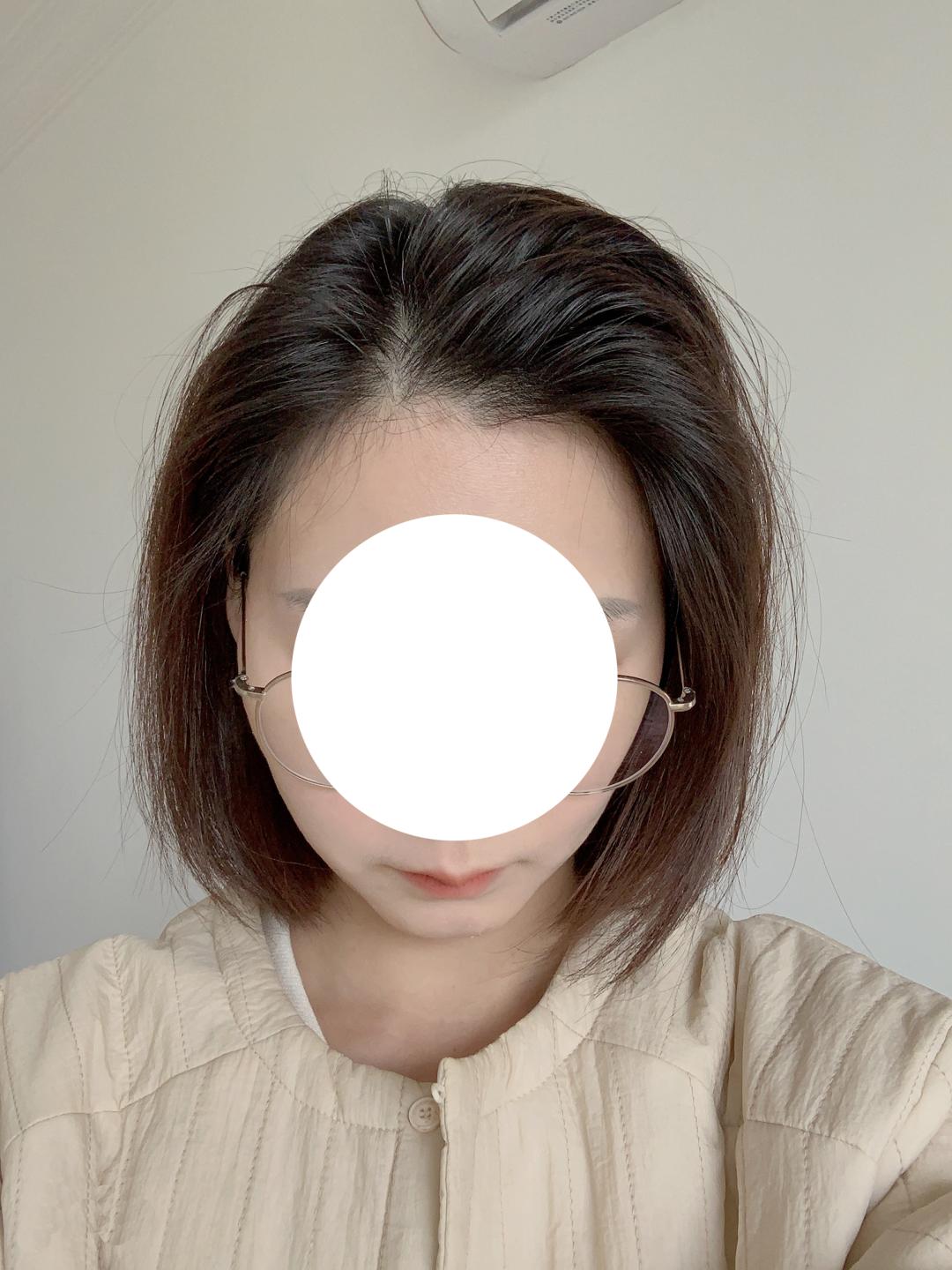 头型尖怎么整容,头型太丑什么发型能补救