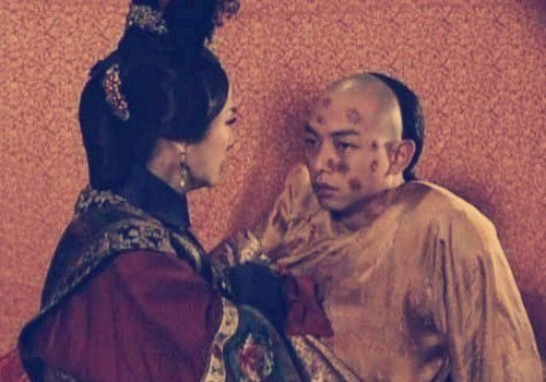 花柳病复发的频率,花柳病为什么会死