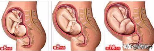 产后腹直肌分离的解决方法,产后腹直肌分离怎么处理