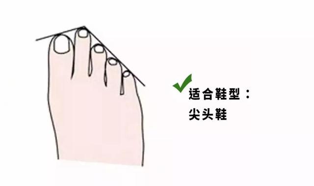 正确的选鞋方法和技巧,买鞋子有什么诀窍吗