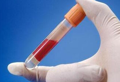 inr是什么东西,inr是哪个国家的币