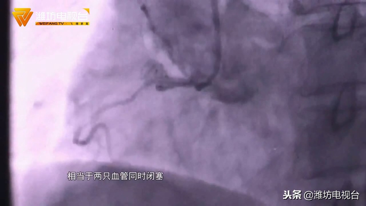 心脏停跳抢救过来多久能醒来,心脏停跳到哪个阶段可以开始抢救