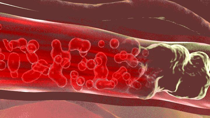穿高领衣服脖子难受综合征,穿低领也会难受是不是衣领综合征
