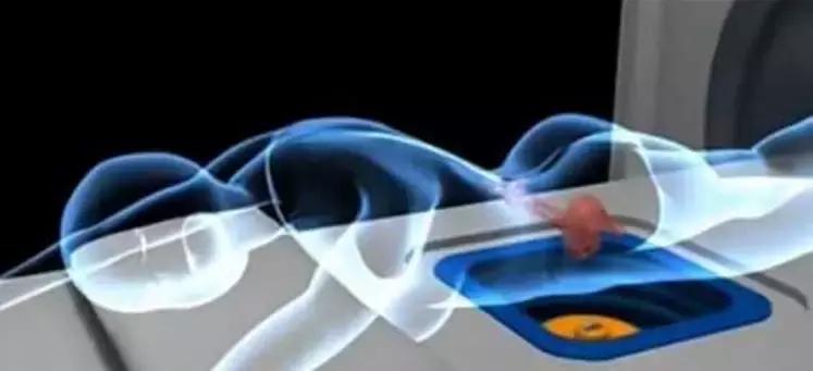 月经量多是不是子宫肌瘤引起的,月经量特别多是子宫肌瘤吗