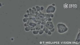 nk细胞疗法可以用于健康人群吗,肿瘤nk细胞疗法