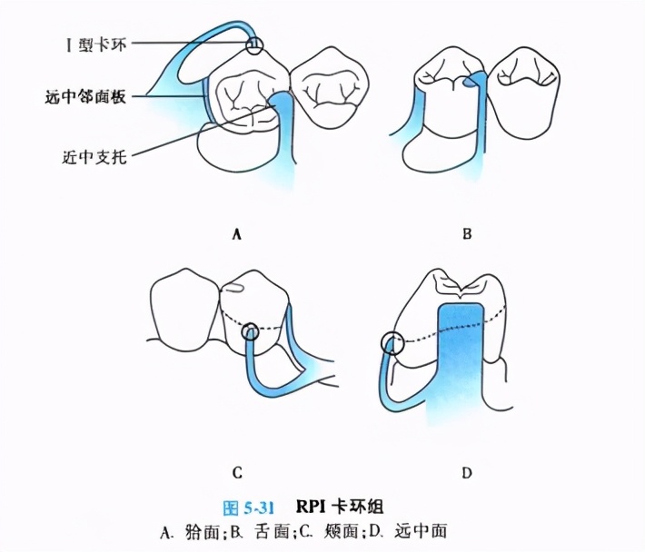 牙列缺损的可摘局部义齿修复题库,牙科美学修复精讲