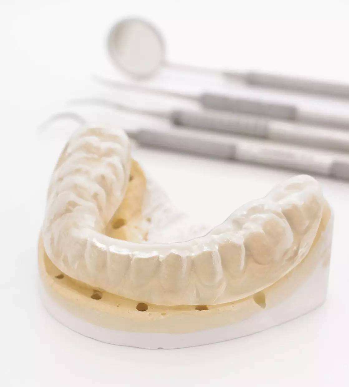 网上几千块牙齿矫正靠谱吗,成人整牙矫正费用