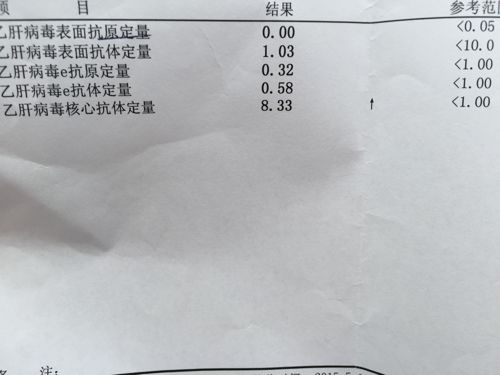 乙肝携带者可以办健康证吗2021,乙肝携带者通过锻炼可以转阴吗