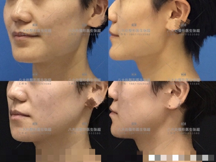 八大处张超抖音,八大处张超合集