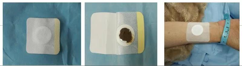 化疗后恶心呕吐怎么可以缓解,化疗后怎么避免恶心呕吐