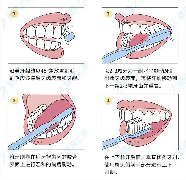 牙齿蛀牙怎么样牙齿才会变好,大牙都是蛀牙怎么改善口腔环境