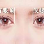 开眼角的魅力有多强,开眼角让你美丽蜕变