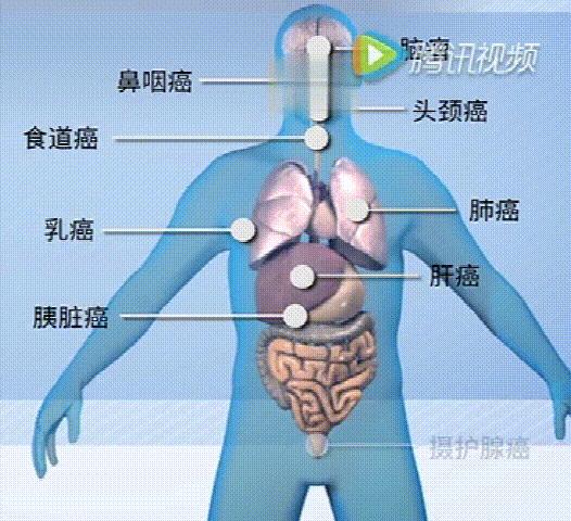 动工！深圳将有全球最准的“质子刀”！李宗伟的鼻咽癌靠它治好