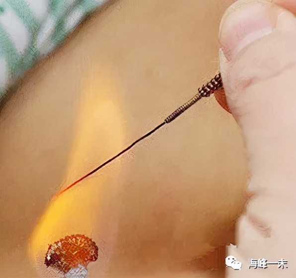 针灸治疗颈椎病扎针技巧,火针治疗颈椎病一次有效果吗