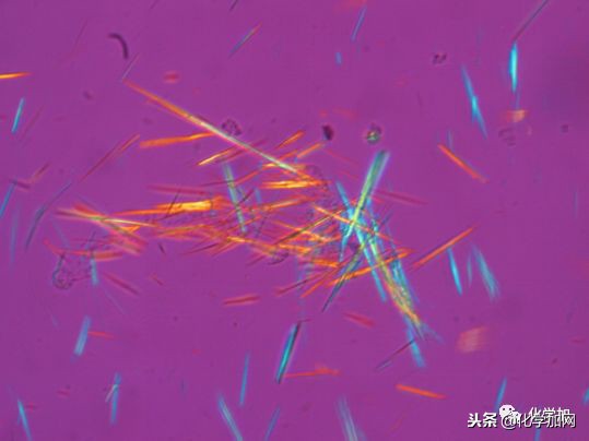 喝酒后手指关节疼怎么回事,喝酒对腿关节疼有影响吗