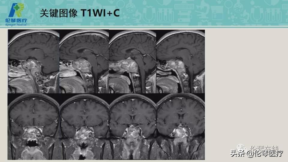 上海教授詹松华,上海曙光医院詹松华简介