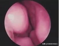 为啥来院就做内镜检查？医生怕是在骗我钱吧