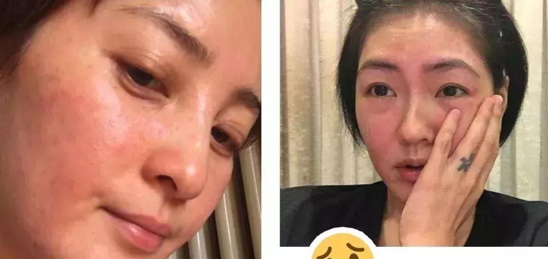皮肤化妆品过敏最快缓解方法,皮肤过敏一定是化妆品的错吗